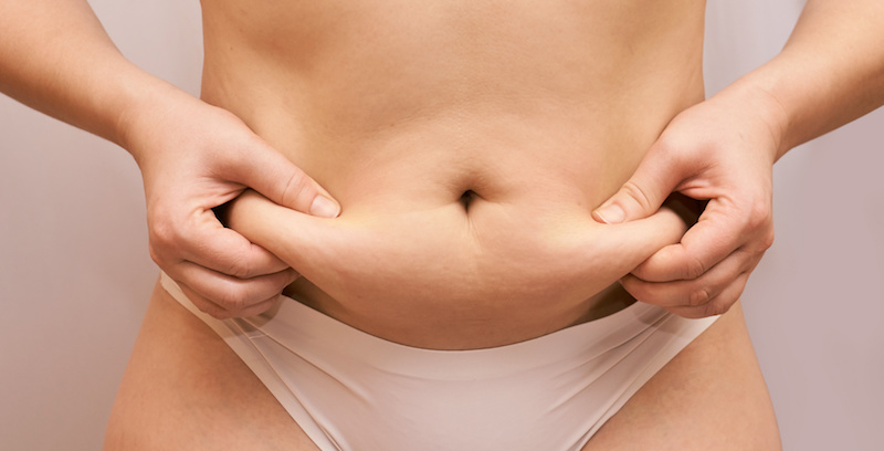 Eliminate Love Handles with Liposuction of the Flanks!