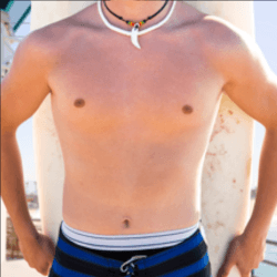 Teen Gynecomastia Surgery